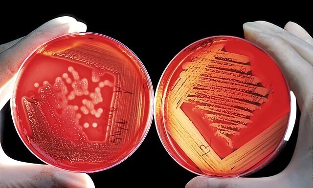 Czy agar jest w Biedronce?